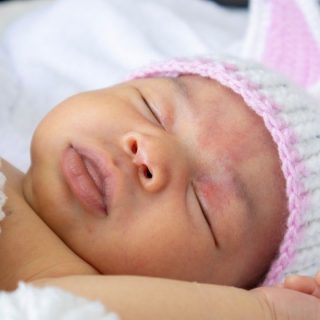 3 things to know about newborn acne 16 Best stroller accessories for every season