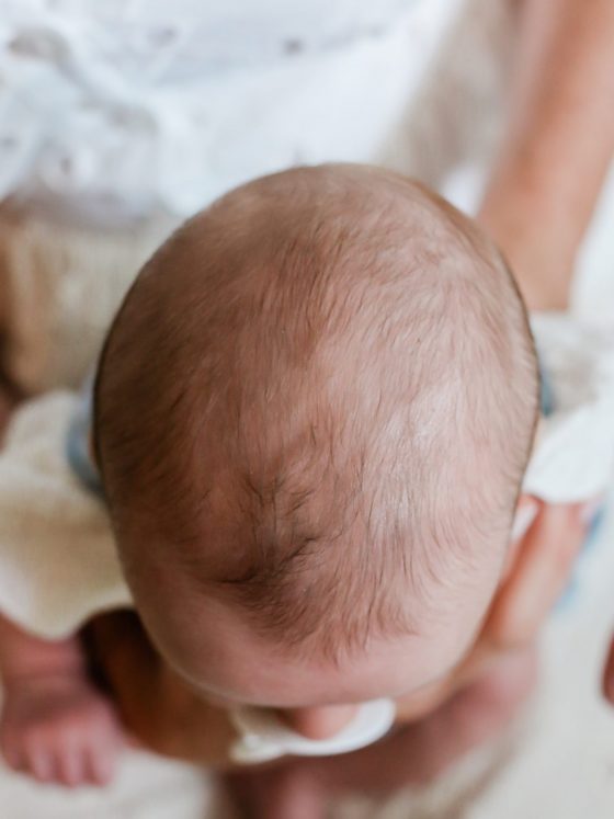 Flat head syndrome and when you should contact a professional 16 Flat head syndrome and when you should contact a professional