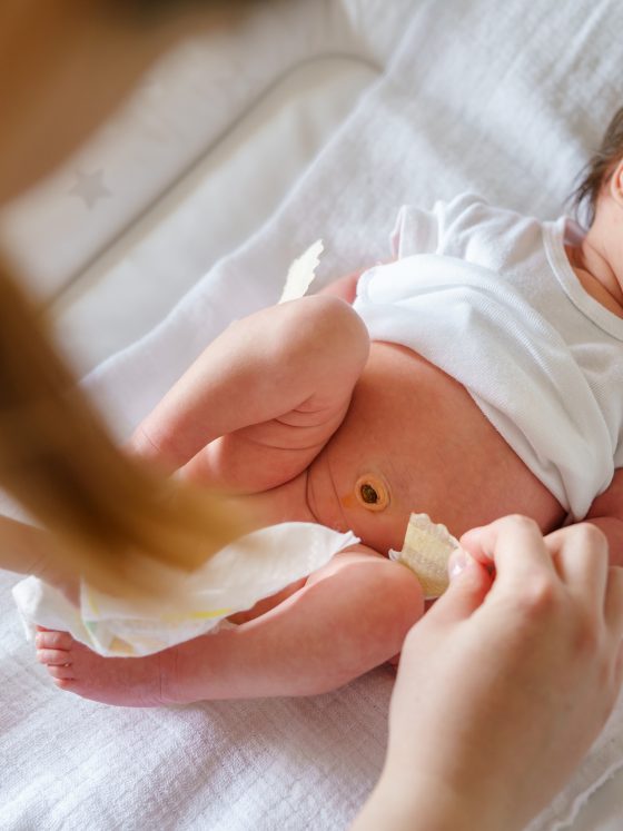 How to care for your baby's umbilical cord 9 How to care for your baby’s umbilical cord
